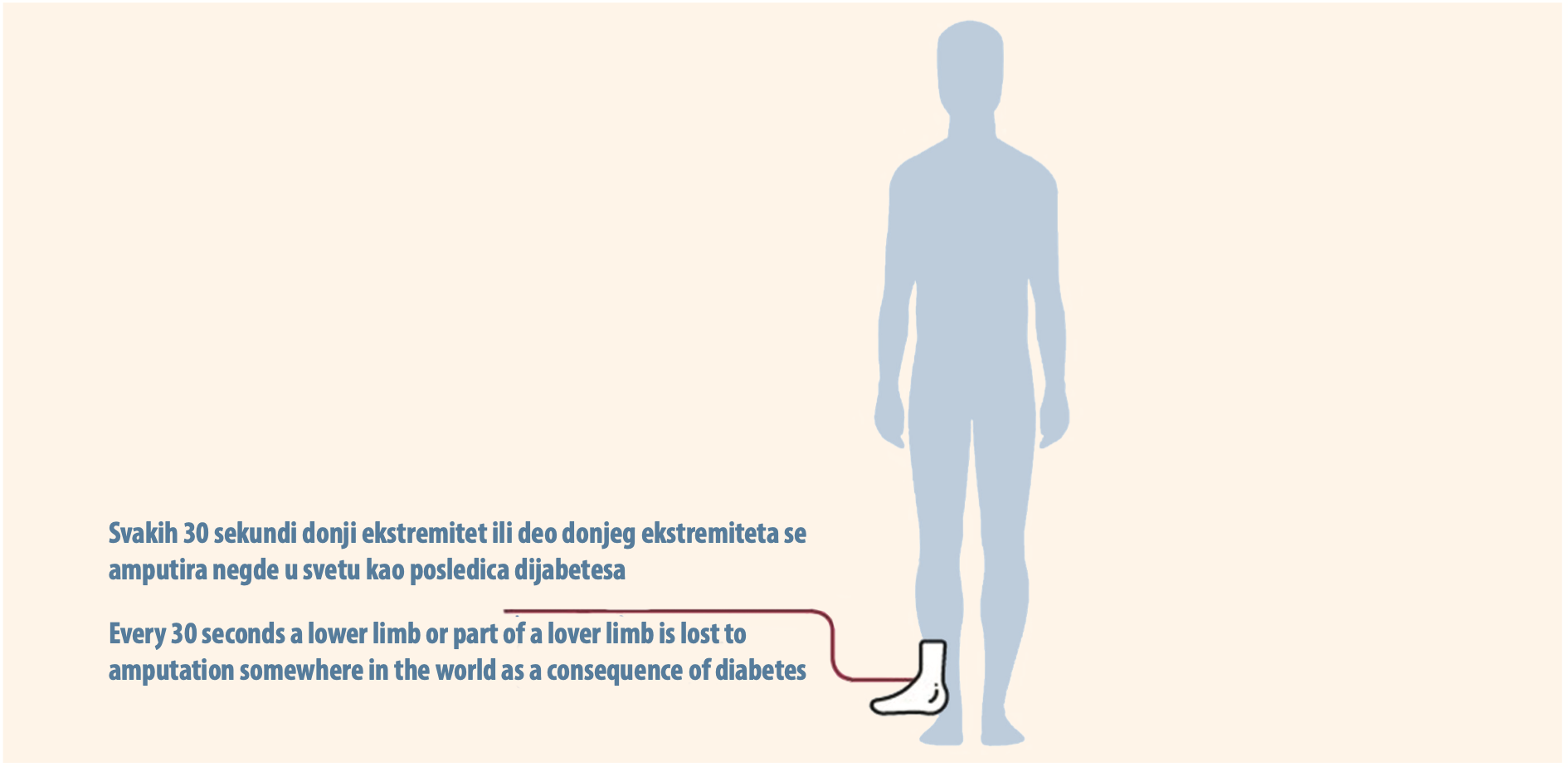 Slika 1. Slika preuzeta sa https://www.idf.org/ ouractivities/careprevention/ diabetic-foot.html