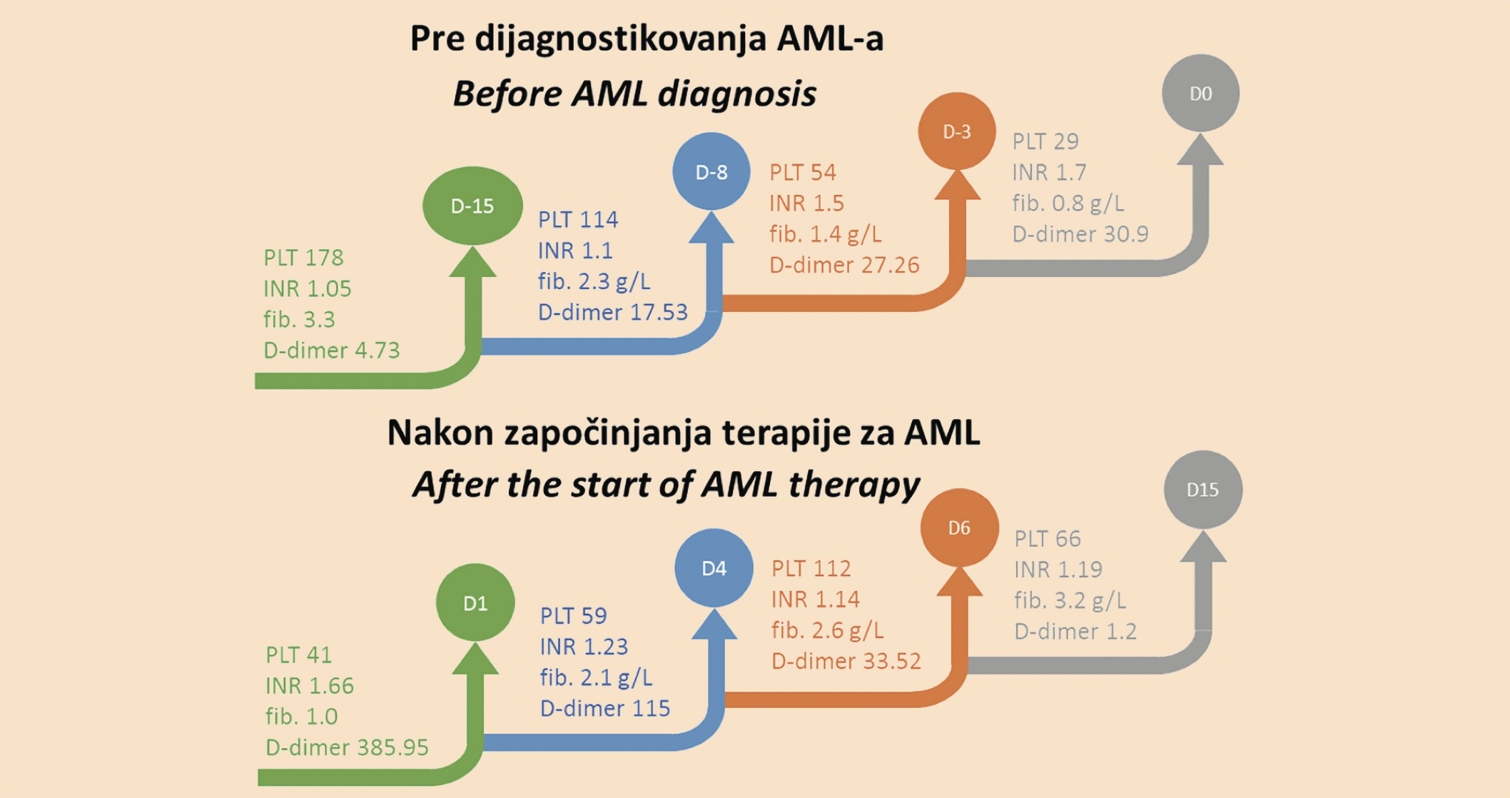 Grafikon 1. Pokazatelji koagulopatije pre i nakon otpočinjanja lečenja AML: AML - akutna monoblasna leukemija; PLT - broj trombocita; INR - internacionalni normalizovani odnos; fib. - fibrinogen; D0 - dan dijagnoze; D1 - dan otpočinjanja lečenja