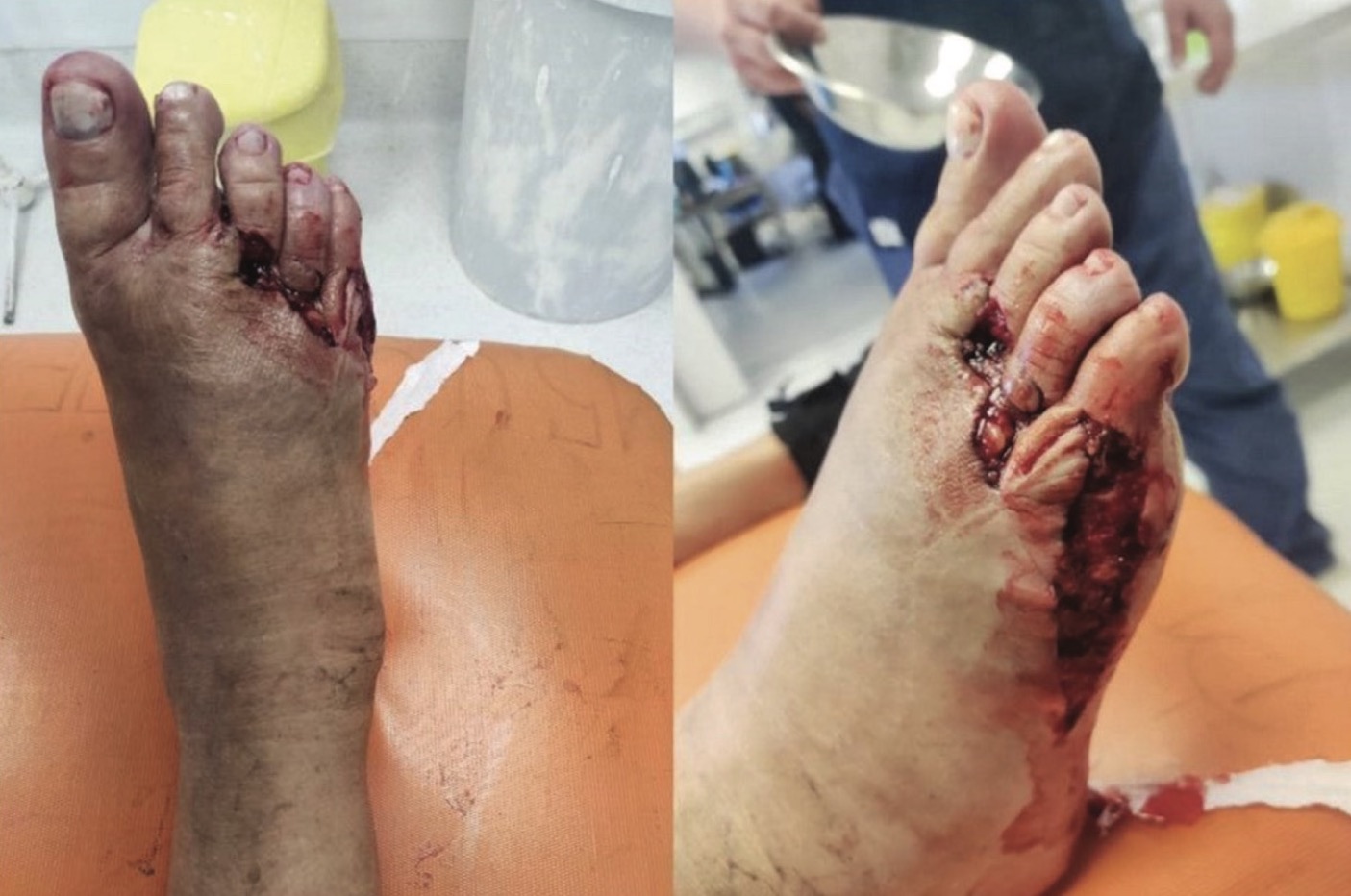 Slika 2. Klinički nalaz povrede
